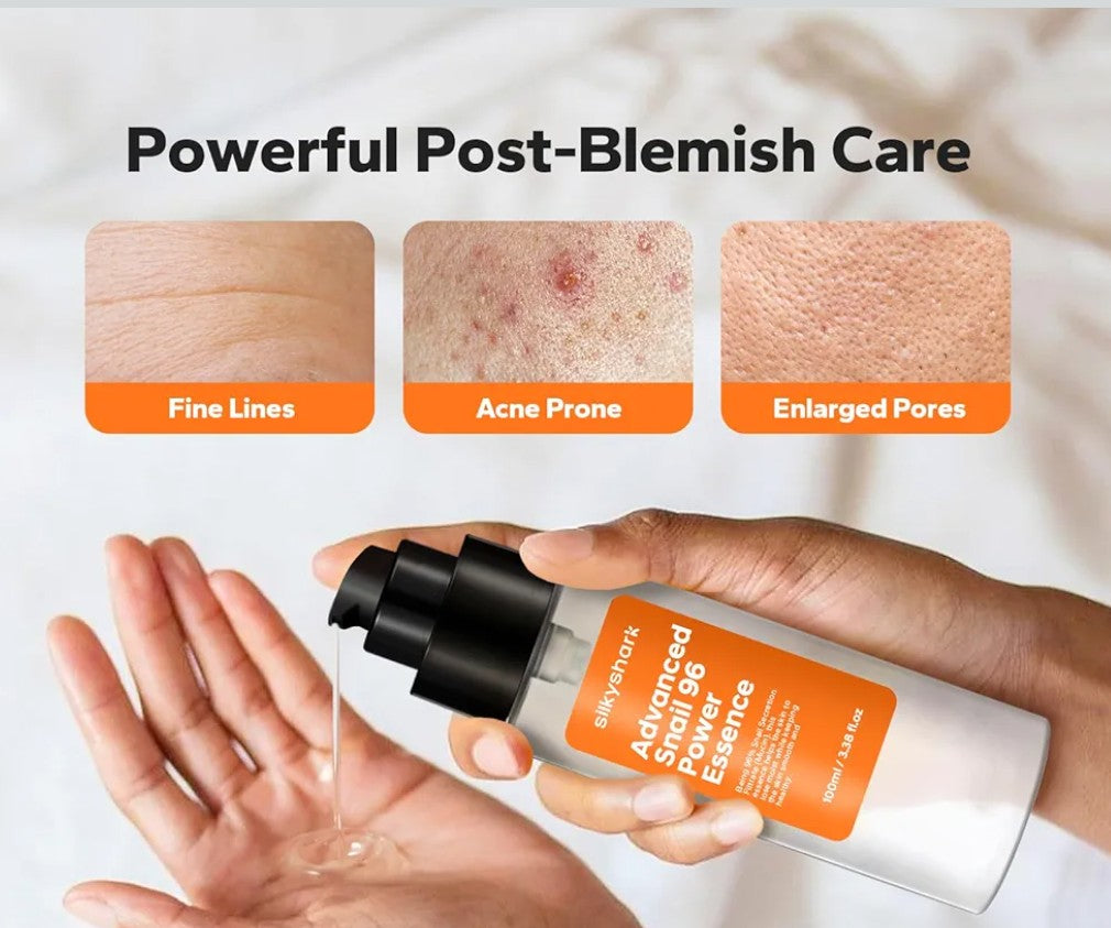 SilkyShark 96% Snail Mucin Serum (3.38 Fl Oz), Snail Secretion Filtrate Power Essence, Facial Skin Care Products with Snail Mucin, Hydrated and Youthful Skin