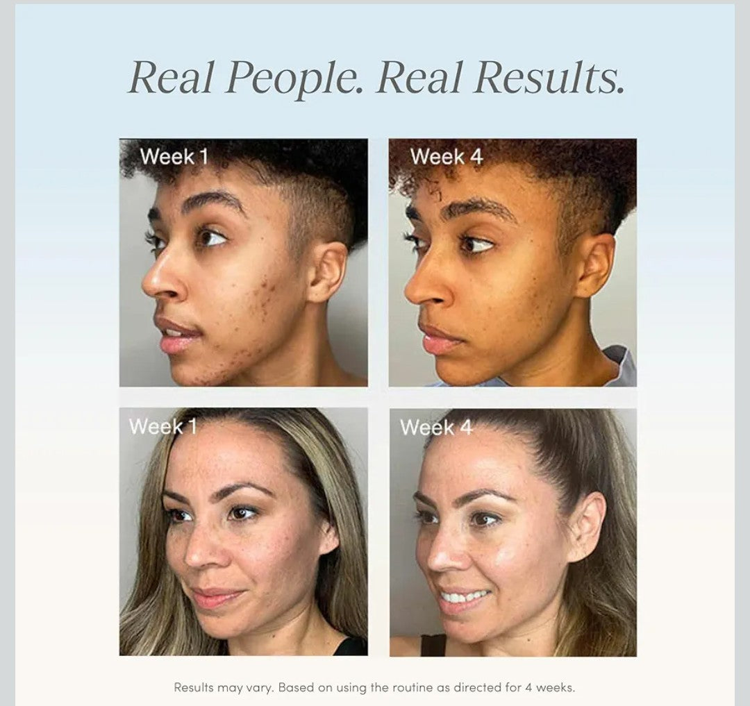 Dark Mark Corrector – 1 fl Oz Dark Mark Corrector – Targets Blemishes – Fragrance-Free with Niacinamide, Bisabolol, Squalane