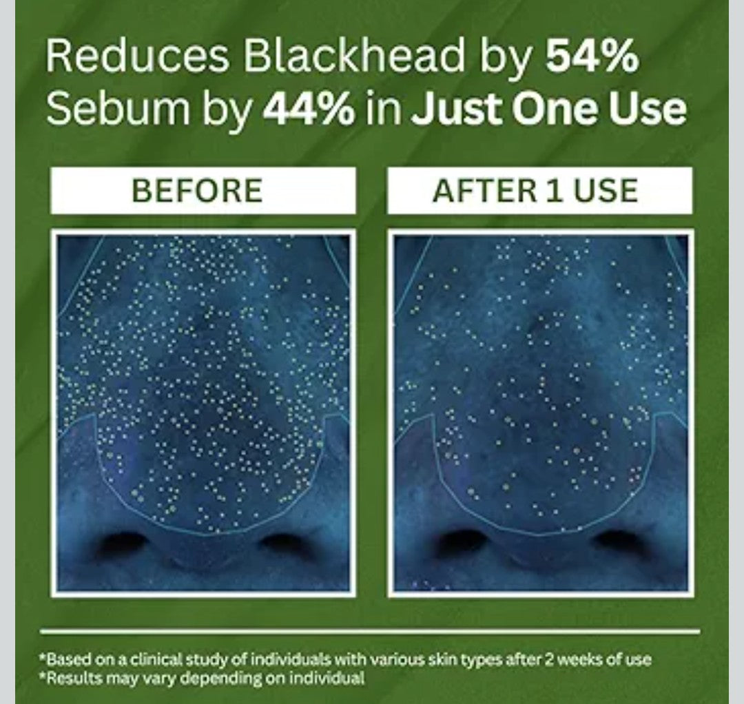 P.CALM Holy Basil Bubble Deep Mask – Holy Basil & Carbonated Water for Cleansing Pores & Blackheads, Korean Clay to Bubble Wash-Off Pack (90g / 3.17 oz)